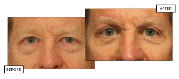 Image may contain Head Person Face Frown Sad Baby Art and Collage